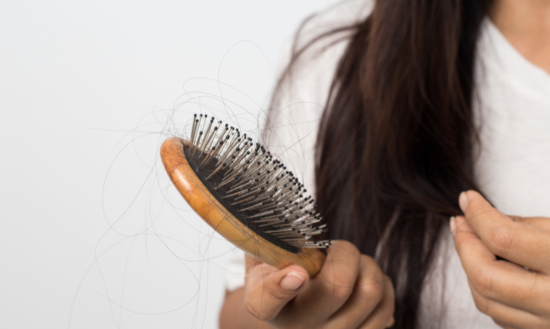 5 Effective Ways to Deal With Hair Loss in the Winter