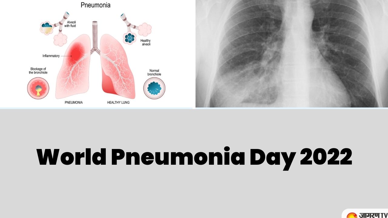 World Pneumonia Day 2022: Theme, History, Significance, and key facts about Pneumonia