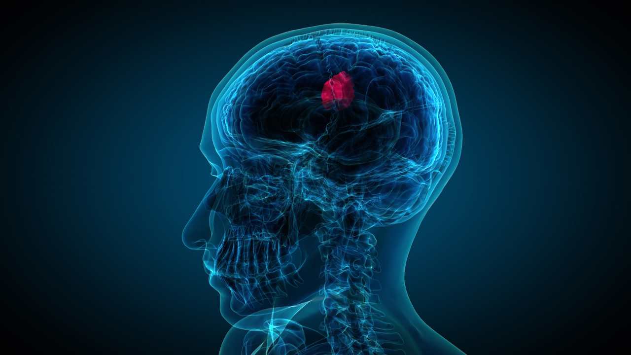 World Brain Tumor Day 2023: Date, History, Theme, Significance ...