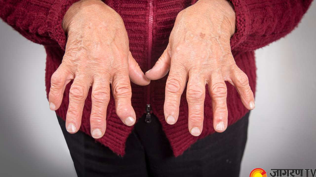 Know everything about Rheumatoid Arthritis, Symptoms, Causes, Age Group ...