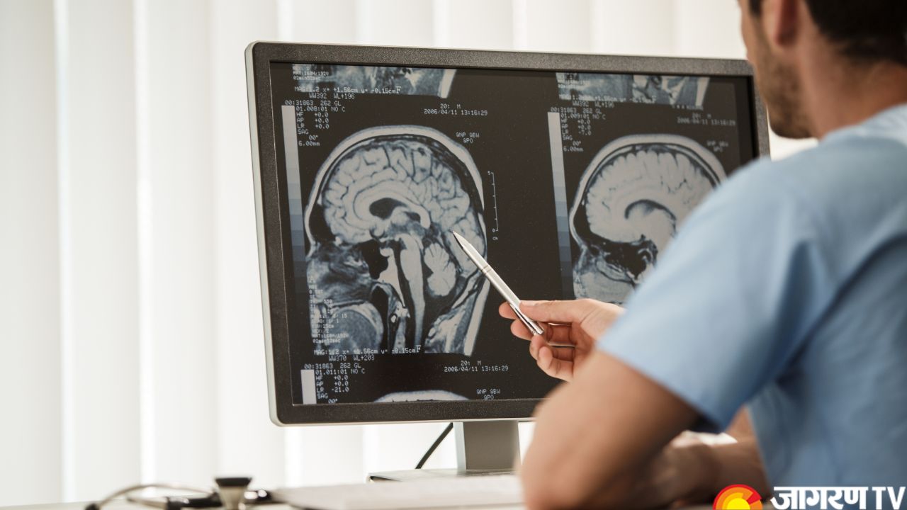 World Brain Tumour Day 2025: Know History, Different Types of Brain Tumour, Subtypes, and More