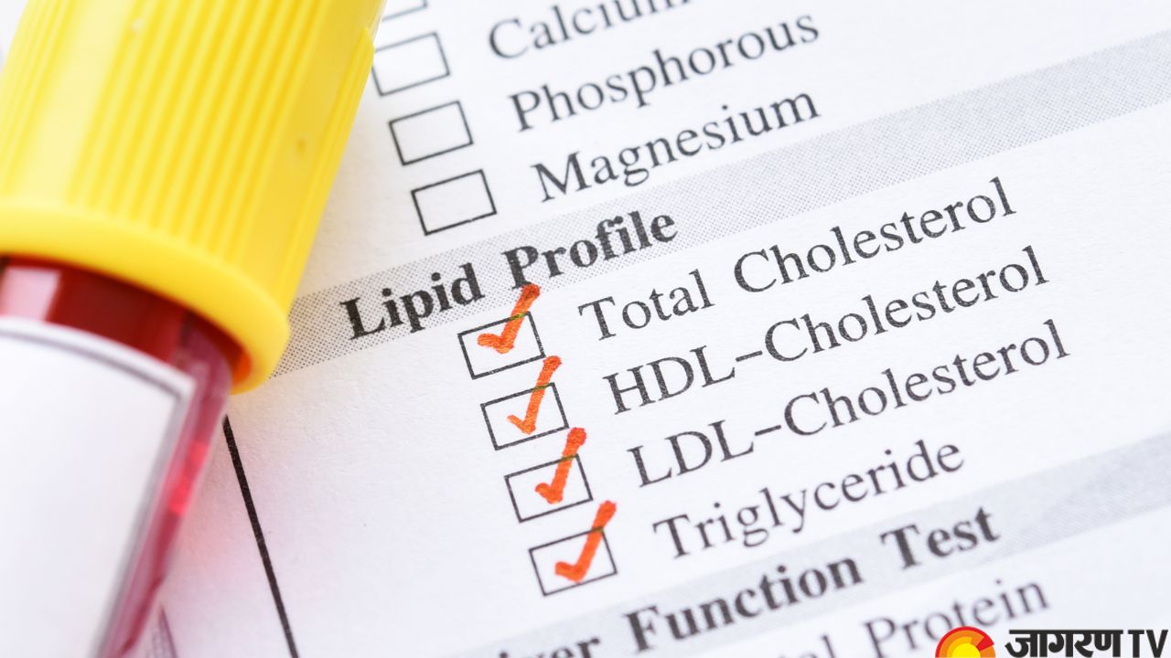Cholesterol: Is Cholesterol Bad or Good For Your Health? Understanding Types, Management, and Dietary Modifications