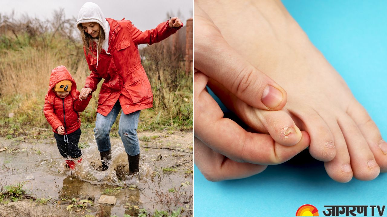 Monsoon Health Care: Common Foot Infections in Rainy Season Due to Dampness, Know Prevention Tips