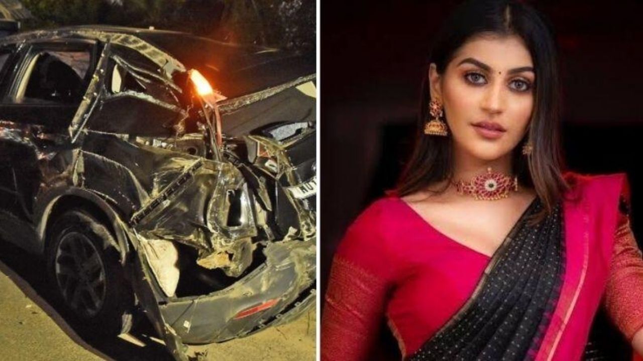 Actress Accident Fire